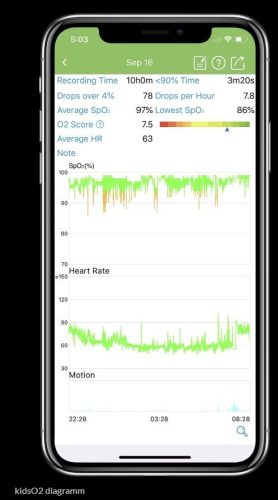 Gyerek oxigén monitor – Pulzoximéter gyűrű – Légzésfigyelő