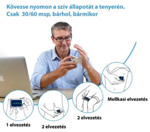 CheckMe Pro / Öndiagnosztikai EKG