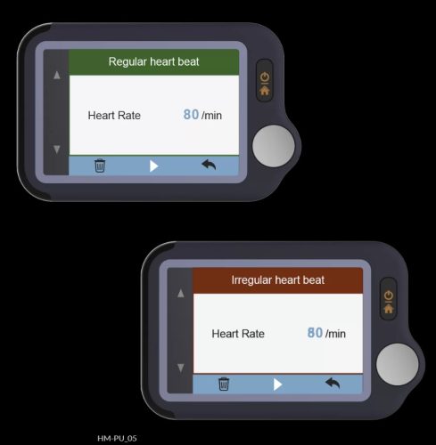Viatom Pulsebit – Személyi EKG nyomkövető /Egészségmonitor